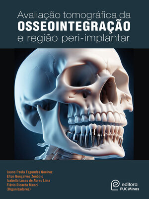 cover image of Avaliação tomográfica da osseointegração e região peri-implantar